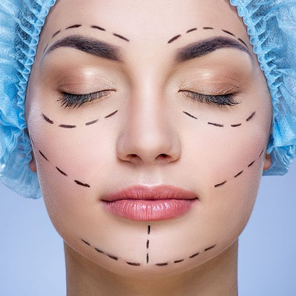 cirugia plastica facial